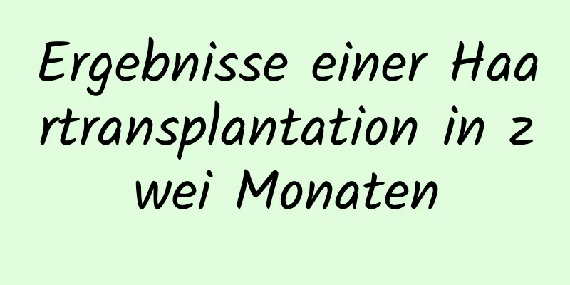 Ergebnisse einer Haartransplantation in zwei Monaten