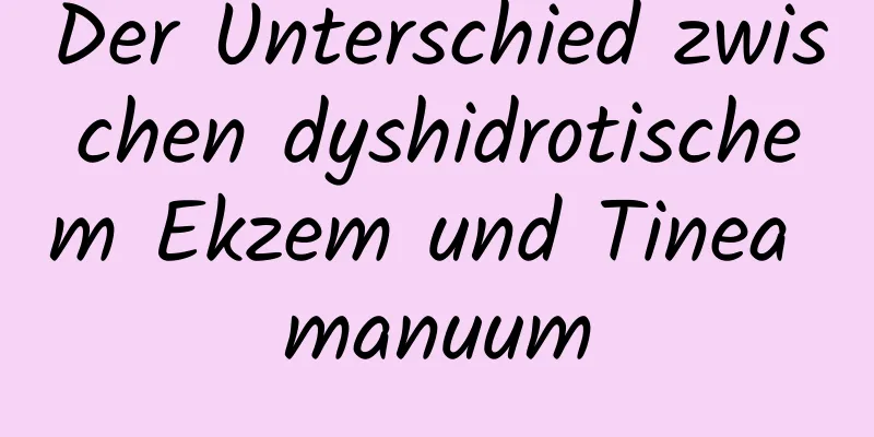 Der Unterschied zwischen dyshidrotischem Ekzem und Tinea manuum