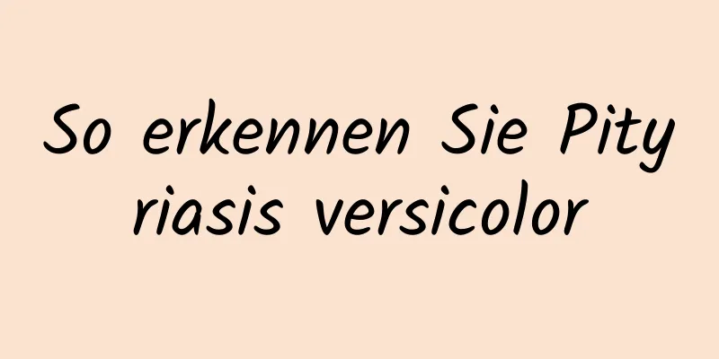 So erkennen Sie Pityriasis versicolor