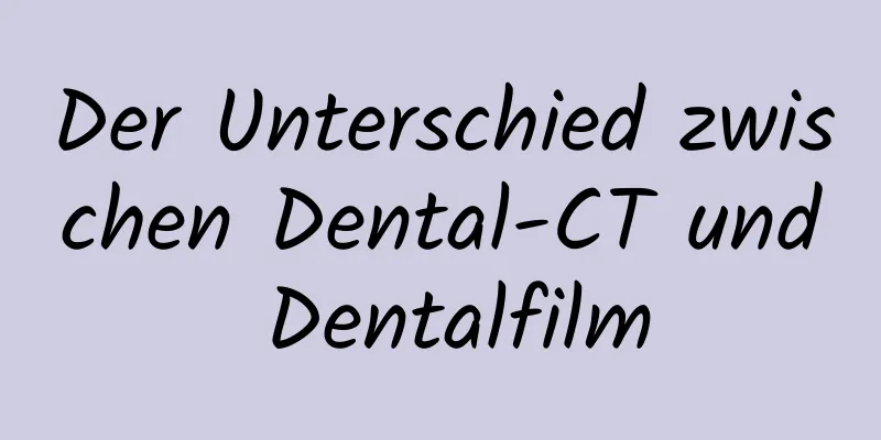 Der Unterschied zwischen Dental-CT und Dentalfilm