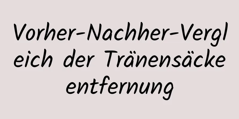 Vorher-Nachher-Vergleich der Tränensäckeentfernung