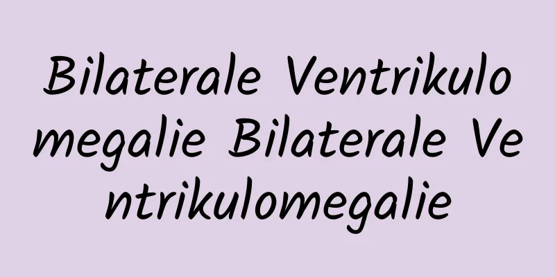 Bilaterale Ventrikulomegalie Bilaterale Ventrikulomegalie