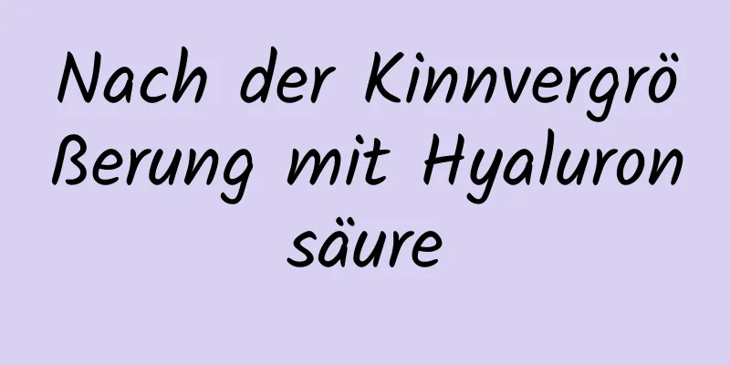 Nach der Kinnvergrößerung mit Hyaluronsäure