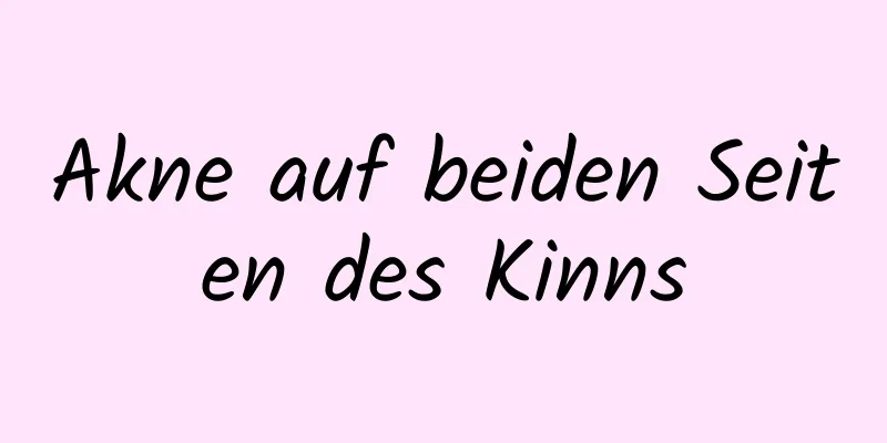 Akne auf beiden Seiten des Kinns