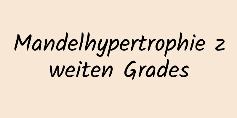 Mandelhypertrophie zweiten Grades