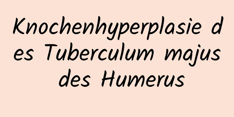 Knochenhyperplasie des Tuberculum majus des Humerus