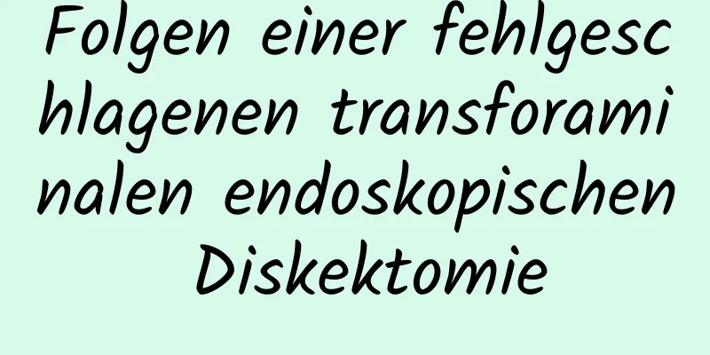 Folgen einer fehlgeschlagenen transforaminalen endoskopischen Diskektomie