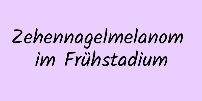 Zehennagelmelanom im Frühstadium