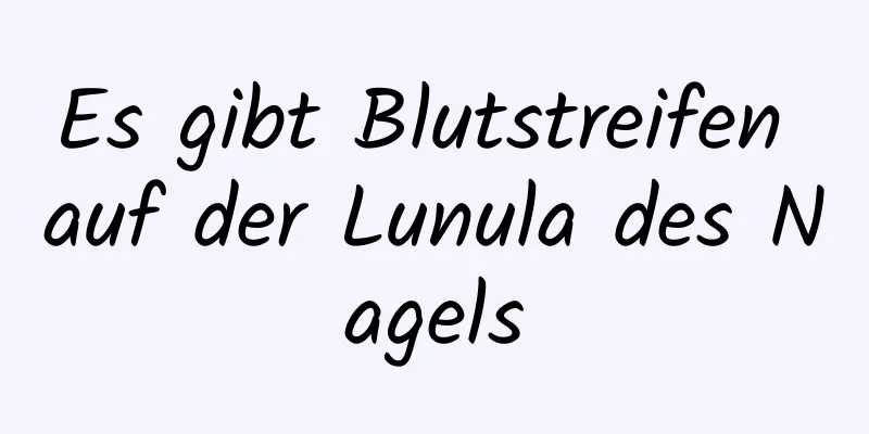 Es gibt Blutstreifen auf der Lunula des Nagels