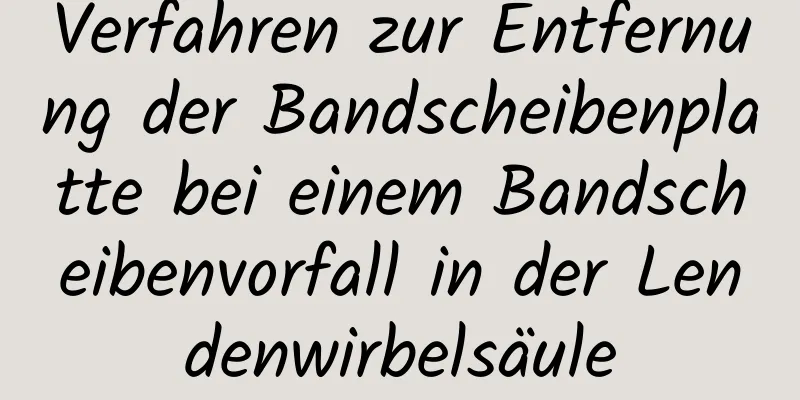 Verfahren zur Entfernung der Bandscheibenplatte bei einem Bandscheibenvorfall in der Lendenwirbelsäule