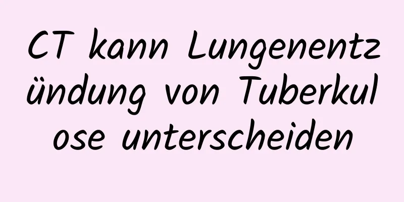 CT kann Lungenentzündung von Tuberkulose unterscheiden