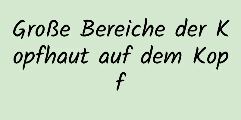 Große Bereiche der Kopfhaut auf dem Kopf