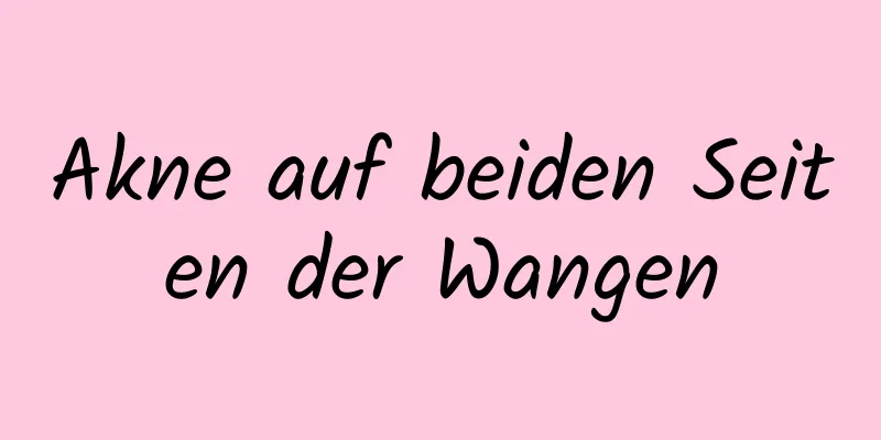 Akne auf beiden Seiten der Wangen