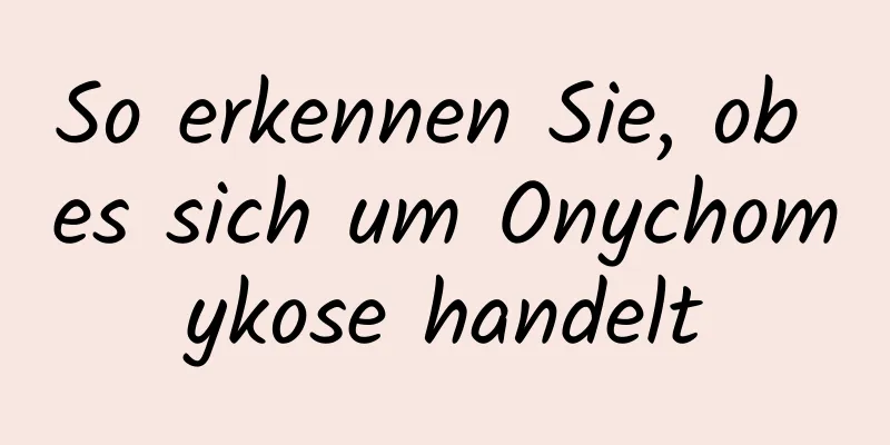 So erkennen Sie, ob es sich um Onychomykose handelt