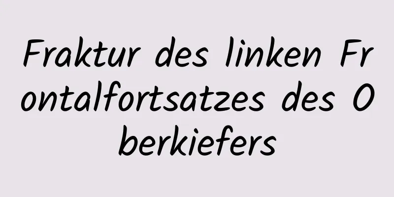 Fraktur des linken Frontalfortsatzes des Oberkiefers