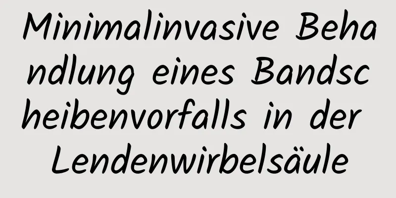 Minimalinvasive Behandlung eines Bandscheibenvorfalls in der Lendenwirbelsäule