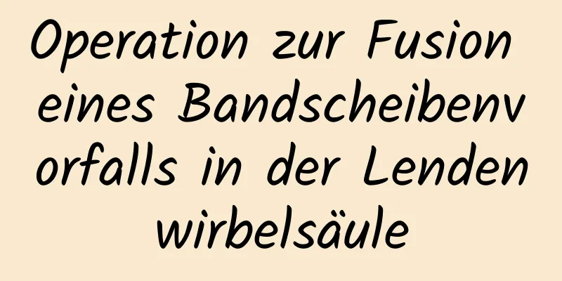 Operation zur Fusion eines Bandscheibenvorfalls in der Lendenwirbelsäule