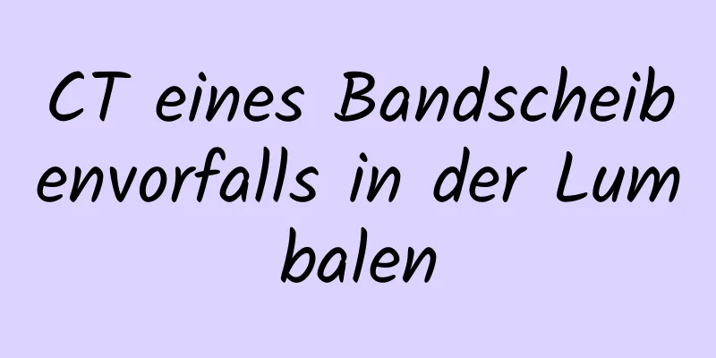 CT eines Bandscheibenvorfalls in der Lumbalen