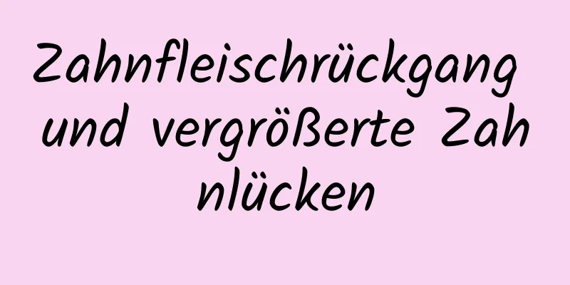 Zahnfleischrückgang und vergrößerte Zahnlücken