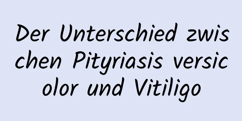 Der Unterschied zwischen Pityriasis versicolor und Vitiligo