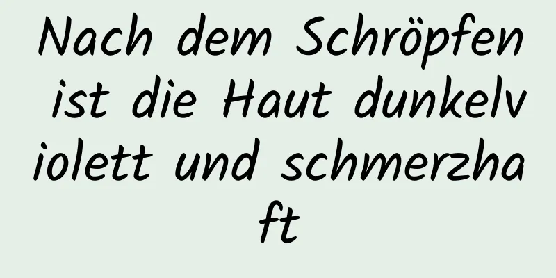 Nach dem Schröpfen ist die Haut dunkelviolett und schmerzhaft