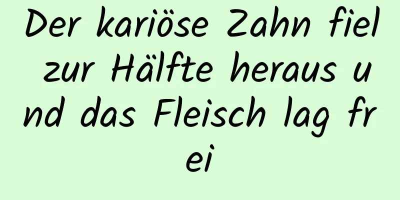 Der kariöse Zahn fiel zur Hälfte heraus und das Fleisch lag frei