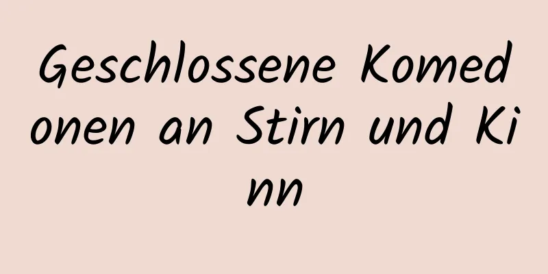 Geschlossene Komedonen an Stirn und Kinn