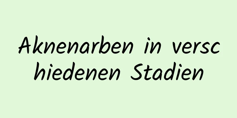 Aknenarben in verschiedenen Stadien