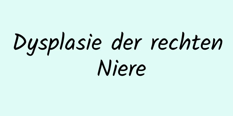 Dysplasie der rechten Niere