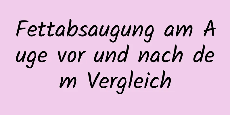 Fettabsaugung am Auge vor und nach dem Vergleich