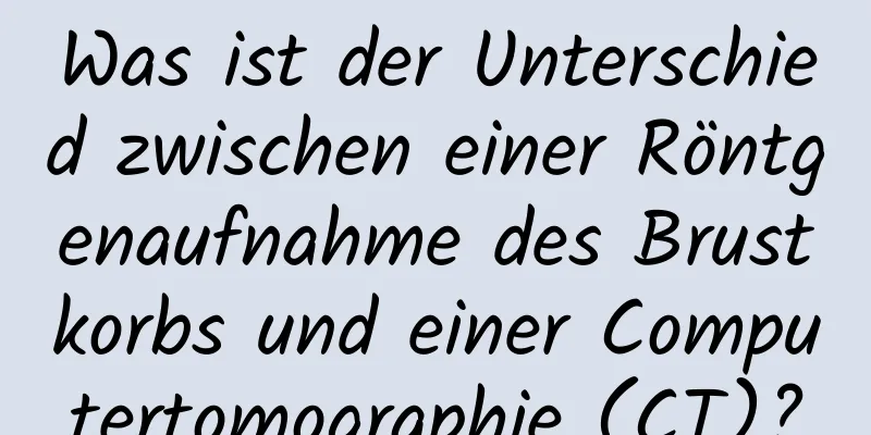 Was ist der Unterschied zwischen einer Röntgenaufnahme des Brustkorbs und einer Computertomographie (CT)?