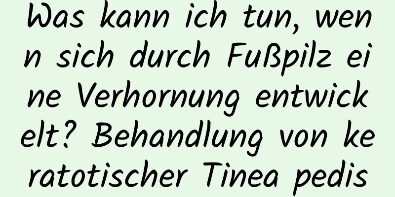 Was kann ich tun, wenn sich durch Fußpilz eine Verhornung entwickelt? Behandlung von keratotischer Tinea pedis