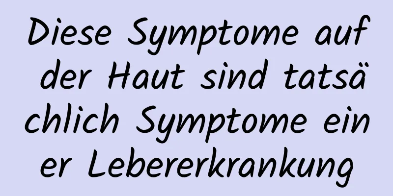 Diese Symptome auf der Haut sind tatsächlich Symptome einer Lebererkrankung