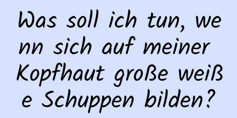Was soll ich tun, wenn sich auf meiner Kopfhaut große weiße Schuppen bilden?