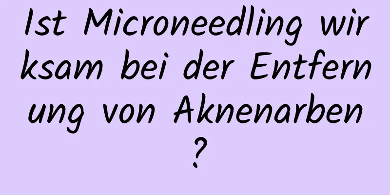 Ist Microneedling wirksam bei der Entfernung von Aknenarben?