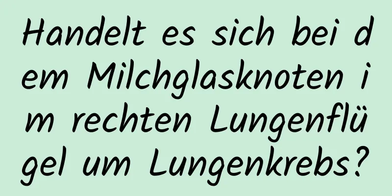 Handelt es sich bei dem Milchglasknoten im rechten Lungenflügel um Lungenkrebs?