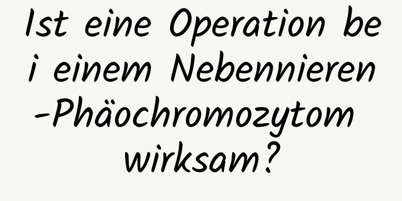 Ist eine Operation bei einem Nebennieren-Phäochromozytom wirksam?
