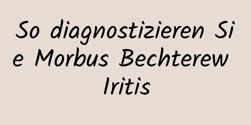 So diagnostizieren Sie Morbus Bechterew Iritis