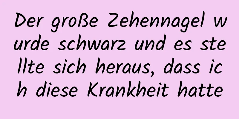 Der große Zehennagel wurde schwarz und es stellte sich heraus, dass ich diese Krankheit hatte