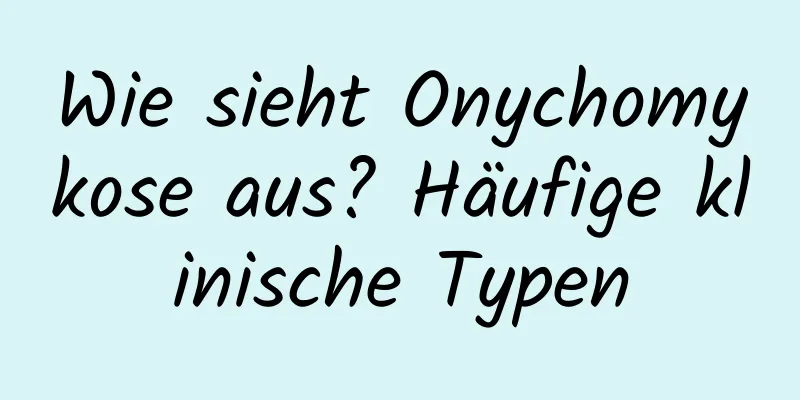 Wie sieht Onychomykose aus? Häufige klinische Typen