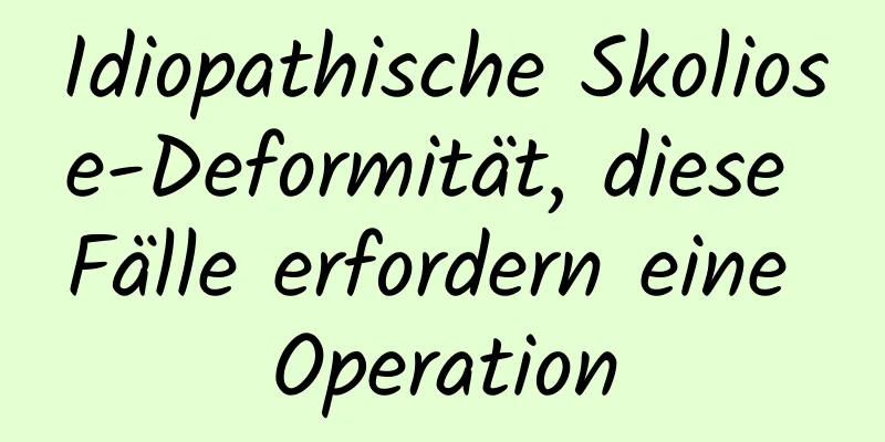 Idiopathische Skoliose-Deformität, diese Fälle erfordern eine Operation