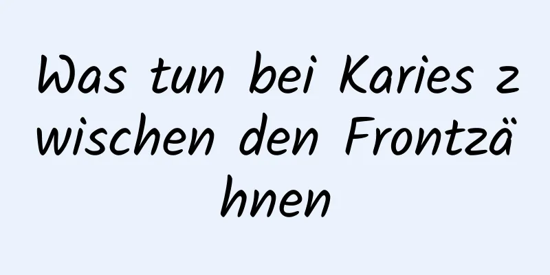 Was tun bei Karies zwischen den Frontzähnen