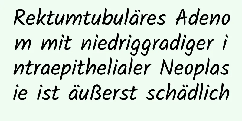 Rektumtubuläres Adenom mit niedriggradiger intraepithelialer Neoplasie ist äußerst schädlich