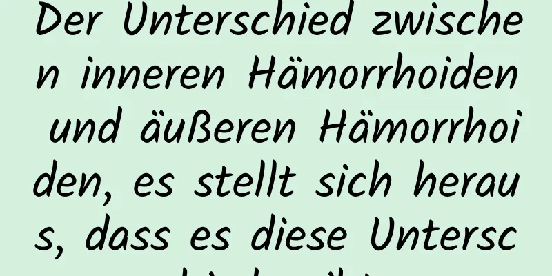 Der Unterschied zwischen inneren Hämorrhoiden und äußeren Hämorrhoiden, es stellt sich heraus, dass es diese Unterschiede gibt