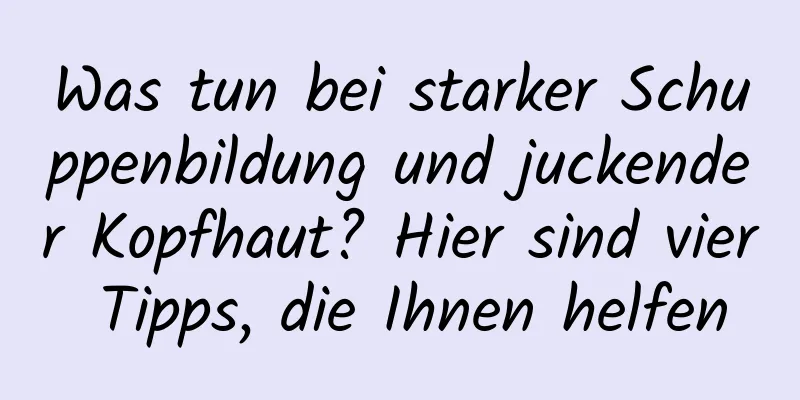 Was tun bei starker Schuppenbildung und juckender Kopfhaut? Hier sind vier Tipps, die Ihnen helfen