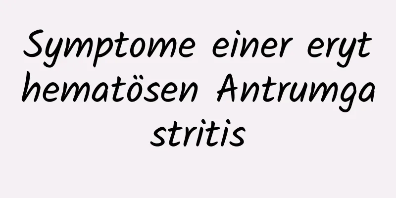 Symptome einer erythematösen Antrumgastritis