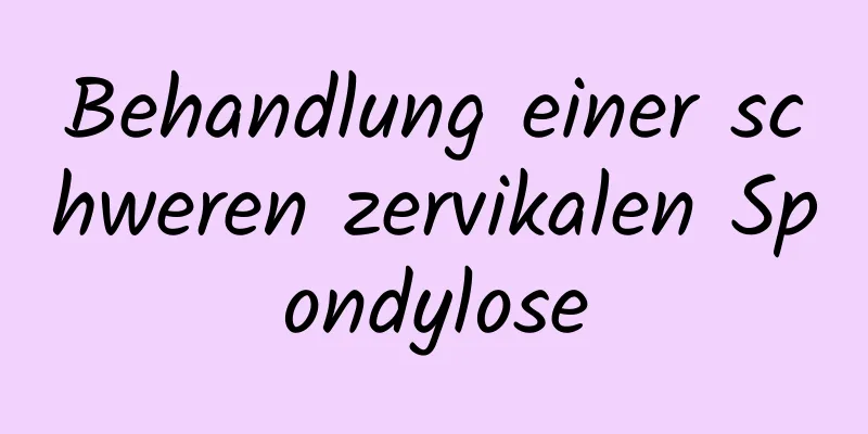 Behandlung einer schweren zervikalen Spondylose