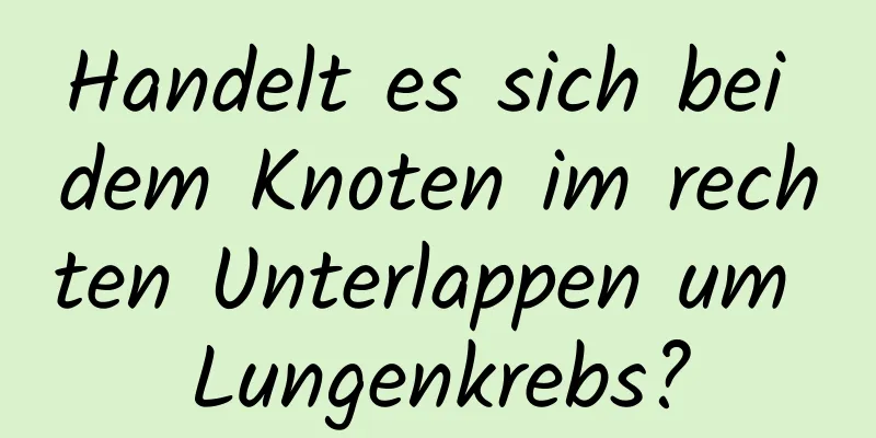 Handelt es sich bei dem Knoten im rechten Unterlappen um Lungenkrebs?