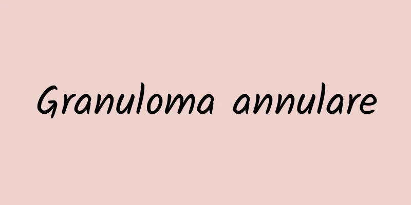 Granuloma annulare